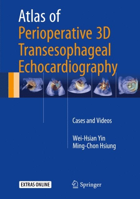 Ming-Chon Hsiung, Wei-Hsian Yin - Atlas of Perioperative 3D Transesophageal Echocardiography, E-bok