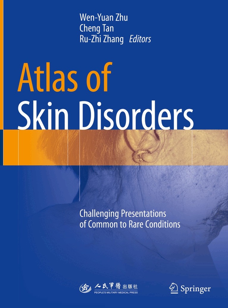 Wen-Yuan Zhu, Cheng Tan, Ru-zhi Zhang - Atlas of Skin Disorders, Inbunden