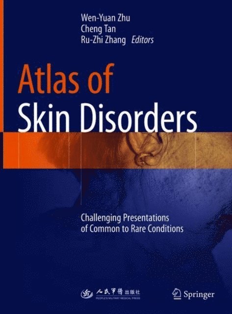 Ru-zhi Zhang, Cheng Tan, Wen-Yuan Zhu - Atlas of Skin Disorders, E-bok