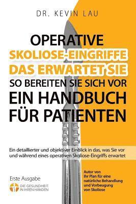 Kevin Lau - Operative Skoliose-Eingriffe - das erwartet Sie - so bereiten Sie sich vor (2.), Häftad