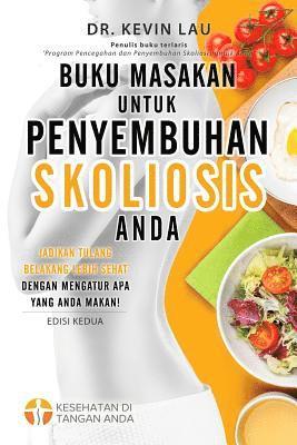 Kevin Lau - Buku Masakan Untuk Penyembuhan Skoliosis Anda (2 Edisi): Panduan Untuk Menyusun Diet Dan Kumpulan Berbagai Resep Lezat Dan Sehat Untuk Skoliosis Anda., Häftad