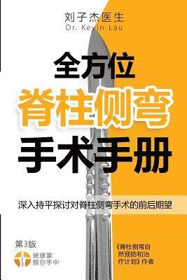 Kevin Lau - The Complete Scoliosis Surgery Handbook for Patients (Chinese, 2nd Edition): An In-Depth and Unbiased Look Into What to Expect Before and During Scoli, Häftad