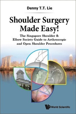 Denny T T Lie - Shoulder Surgery Made Easy!: The Singapore Shoulder & Elbow Society Guide To Arthroscopic And Open Shoulder Procedures, Inbunden