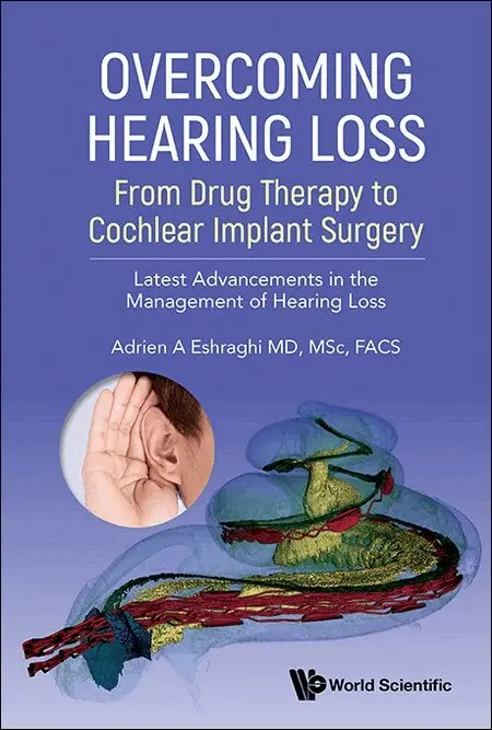 Eshraghi Adrien a, Adrien A Eshraghi - OVERCOMING HEARING LOSS: FROM DRUG THERAPY TO COCHLEAR IMPLANT SURGERY - LATEST ADVANCEMENTS IN THE MANAGEMENT OF HEARING LOSS, Häftad. Tillgänglighet: Lägg i varukorg