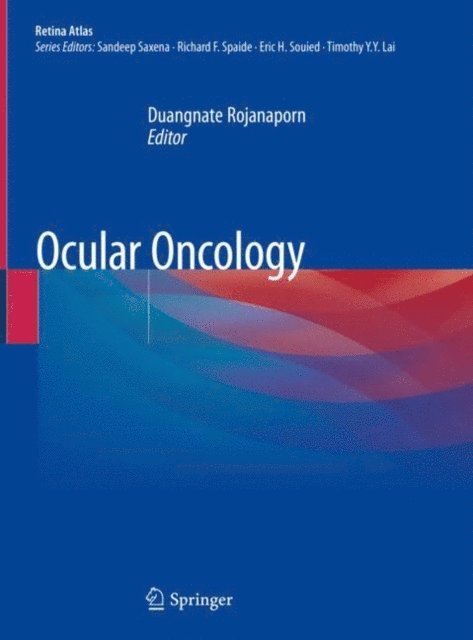 Duangnate Rojanaporn - Ocular Oncology, E-bok