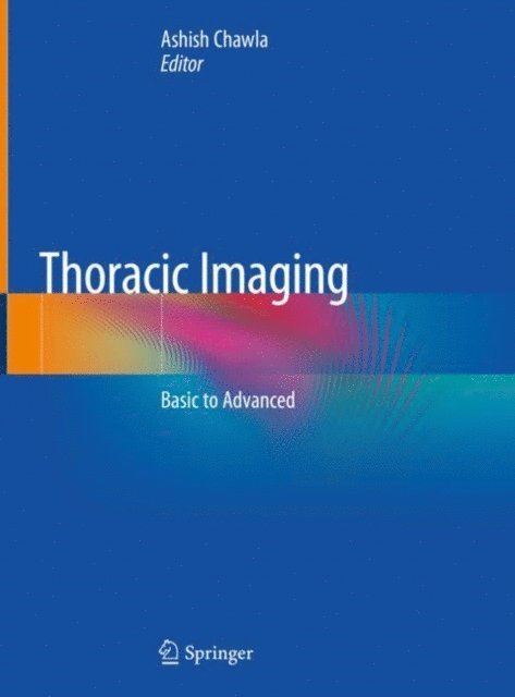 Ashish Chawla - Thoracic Imaging, E-bok