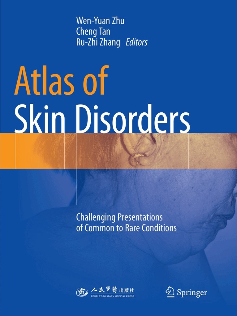 Wen-Yuan Zhu, Cheng Tan, Ru-zhi Zhang - Atlas of Skin Disorders, Häftad