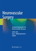Neurovascular Surgery