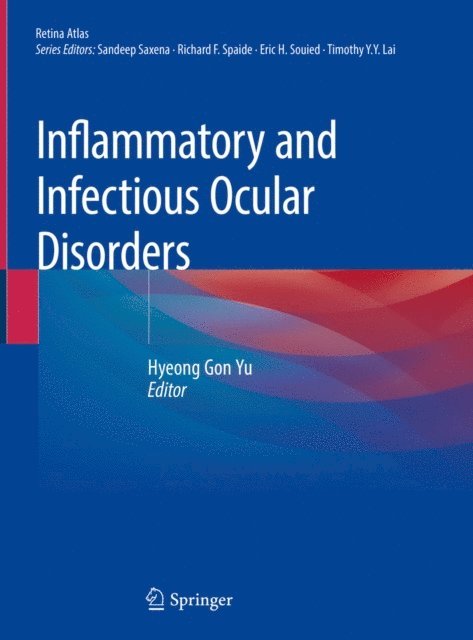 Hyeong Gon Yu - Inflammatory and Infectious Ocular Disorders, E-bok