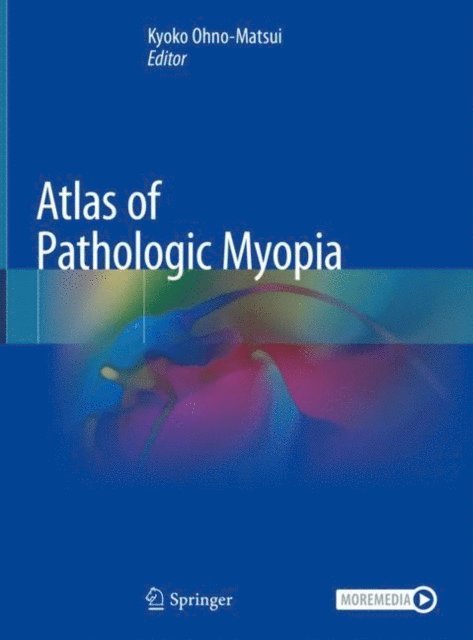 Kyoko Ohno-Matsui - Atlas of Pathologic Myopia, E-bok