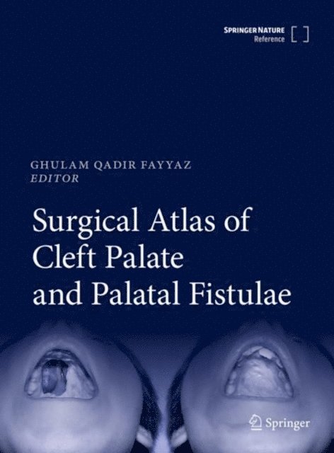 Ghulam Qadir Fayyaz - Surgical Atlas of Cleft Palate and Palatal Fistulae, E-bok