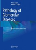 Pathology of Glomerular Diseases