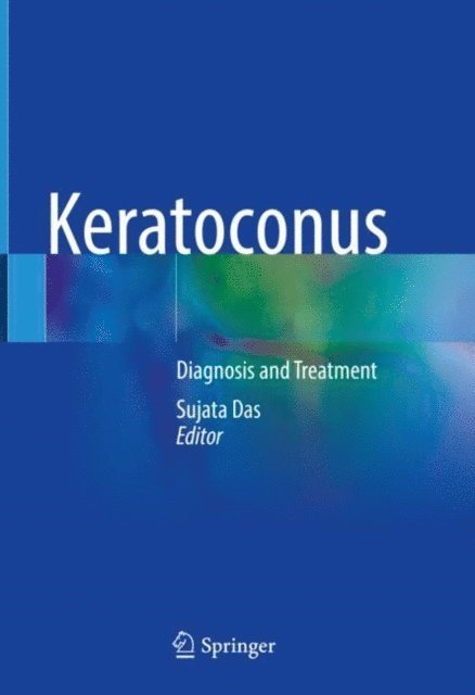 Sujata Das - Keratoconus, E-bok
