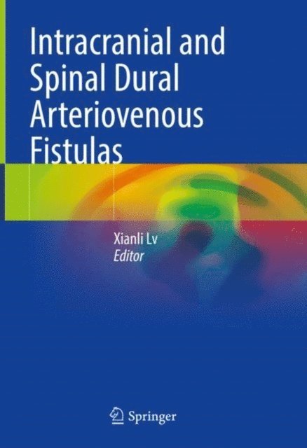 Xianli Lv - Intracranial and Spinal Dural Arteriovenous Fistulas, E-bok
