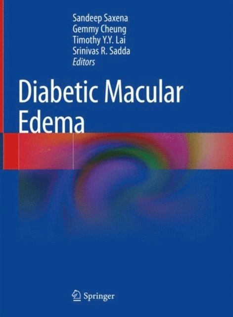 Srinivas R. Sadda, Timothy Y.Y. Lai, Gemmy Cheung, Sandeep Saxena - Diabetic Macular Edema, E-bok