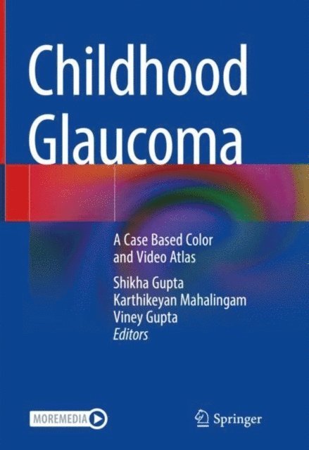 Viney Gupta, Karthikeyan Mahalingam, Shikha Gupta - Childhood Glaucoma, E-bok