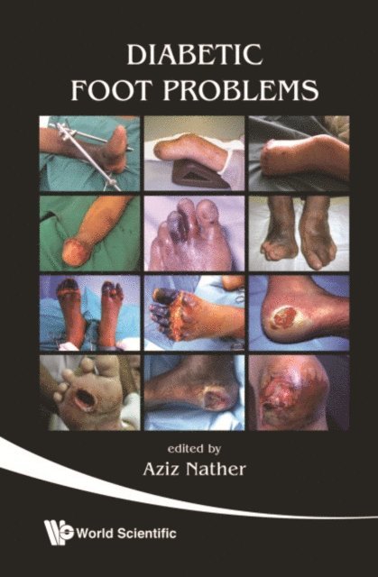 Diabetic Foot Problems
