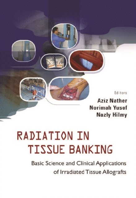 Hilmy Nazly Hilmy, Yusof Norimah Yusof, Nather Abdul Aziz Nather - Radiation In Tissue Banking: Basic Science And Clinical Applications Of Irradiated Tissue Allografts, E-bok. Tillgänglighet: Lägg i varukorg