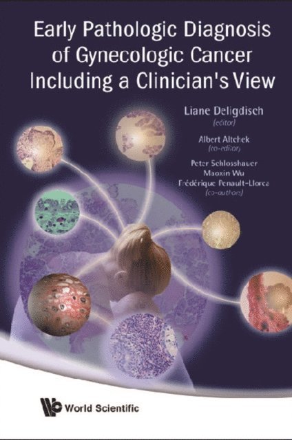 Altchek Albert Altchek, Schlosshauer Peter W Schlosshauer, Llorca Frederique Penault Llorca, Deligdisch Liane Deligdisch, Wu Maoxin Wu - Early Pathologic Diagnosis Of Gynecologic Cancer Including A Clinician's View, E-bok. Tillgänglighet: Lägg i varukorg