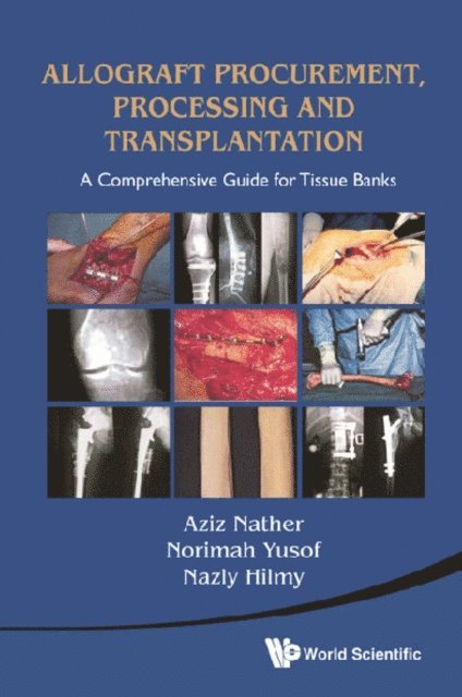 Nather Abdul Aziz Nather, Hilmy Nazly Hilmy, Yusof Norimah Yusof - Allograft Procurement, Processing And Transplantation: A Comprehensive Guide For Tissue Banks, E-bok. Tillgänglighet: Lägg i varukorg