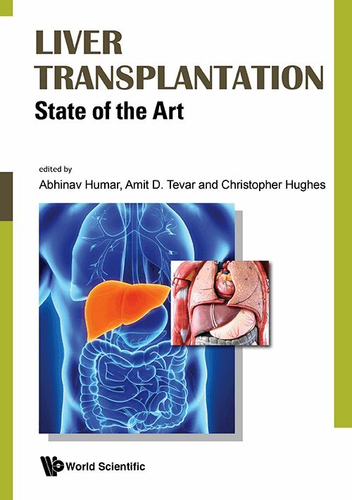 Humar Abhinav, Abhinav Humar, Amit Tevar, Christopher Hughes - LIVER TRANSPLANTATION: STATE OF THE ART, Inbunden. Tillgänglighet: Lägg i varukorg
