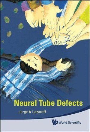 Jorge A Lazareff - Neural Tube Defects, Inbunden