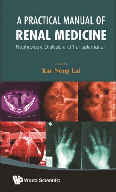Lai Kar Neng Lai - Practical Manual Of Renal Medicine, A: Nephrology, Dialysis And Transplantation, E-bok. Tillgänglighet: Lägg i varukorg
