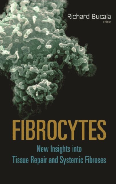 Bucala Richard Bucala - Fibrocytes: New Insights Into Tissue Repair And Systemic Fibroses, E-bok. Tillgänglighet: Lägg i varukorg