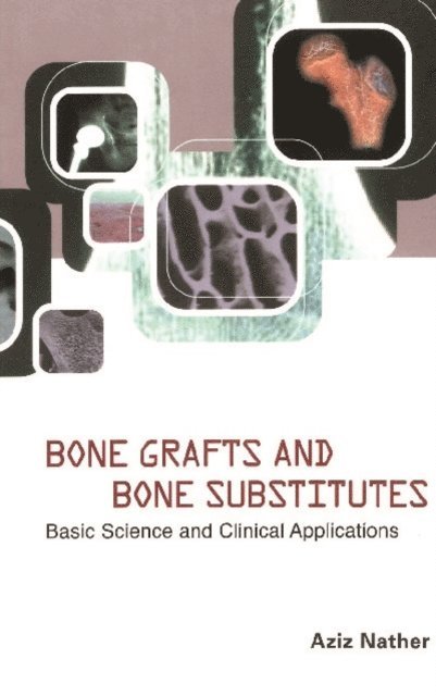 Nather Abdul Aziz Nather - Bone Grafts And Bone Substitutes: Basic Science And Clinical Applications, E-bok. Tillgänglighet: Lägg i varukorg