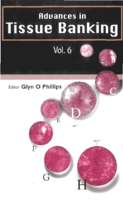 Phillips Glyn O Phillips - Advances In Tissue Banking, Vol. 6, E-bok. Tillgänglighet: Lägg i varukorg