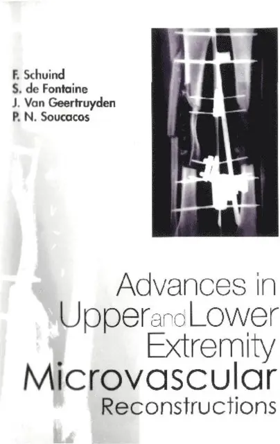 Soucacos Panayotis N Soucacos, Schuind F Schuind, Geertruyden Jean Van Geertruyden, Fontaine S De Fontaine - Advances In Upper And Lower Extremity Microvascular Reconstructions, E-bok. Tillgänglighet: Lägg i varukorg