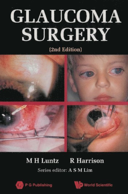 Harrison Raymond Harrison, Luntz Maurice H Luntz - Glaucoma Surgery (2nd Edition), E-bok
