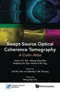 Swept-source Optical Coherence Tomography: A Color Atlas