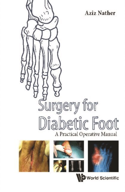 Nather Abdul Aziz Nather - Surgery For Diabetic Foot: A Practical Operative Manual, E-bok. Tillgänglighet: Lägg i varukorg