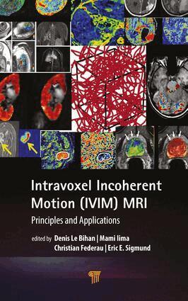 Denis Le Bihan, Mami Iima, Christian Federau, Eric E. Sigmund - Intravoxel Incoherent Motion (IVIM) MRI, Inbunden