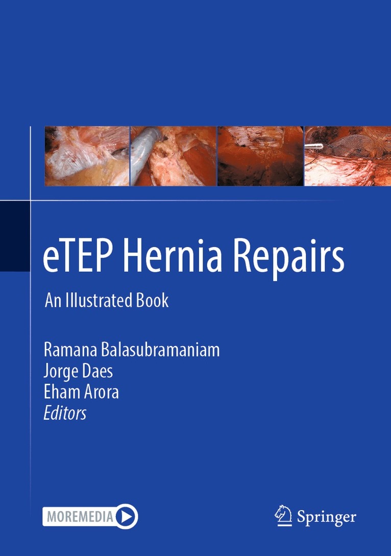 eTEP Hernia Repairs