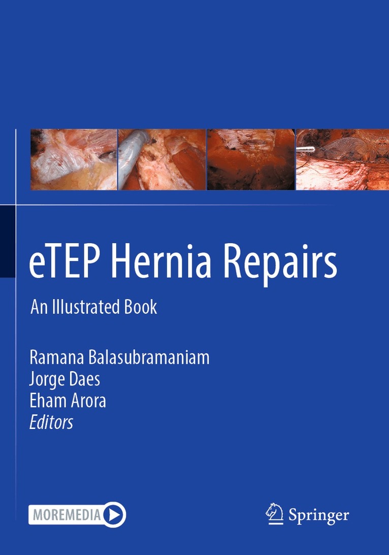 Ramana Balasubramaniam, Jorge Daes, Eham Arora - eTEP Hernia Repairs, Häftad. Tillgänglighet: Lägg i varukorg