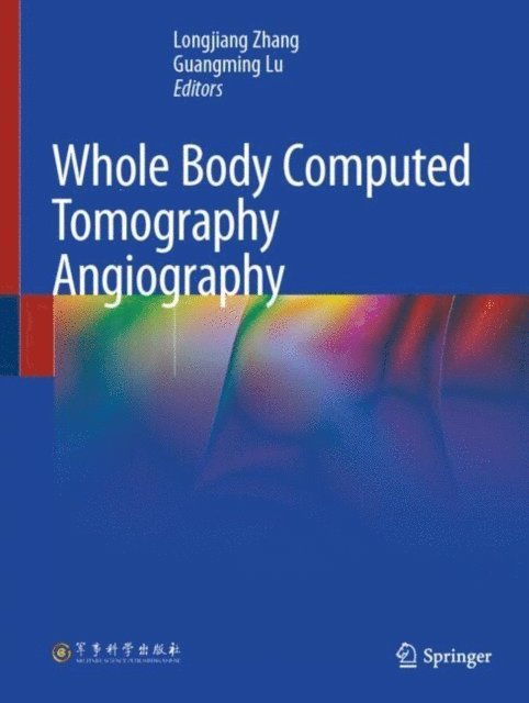 Guangming Lu, Longjiang Zhang - Whole Body Computed Tomography Angiography, E-bok