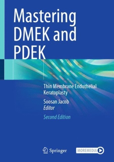 Soosan Jacob - Mastering DMEK and PDEK, E-bok