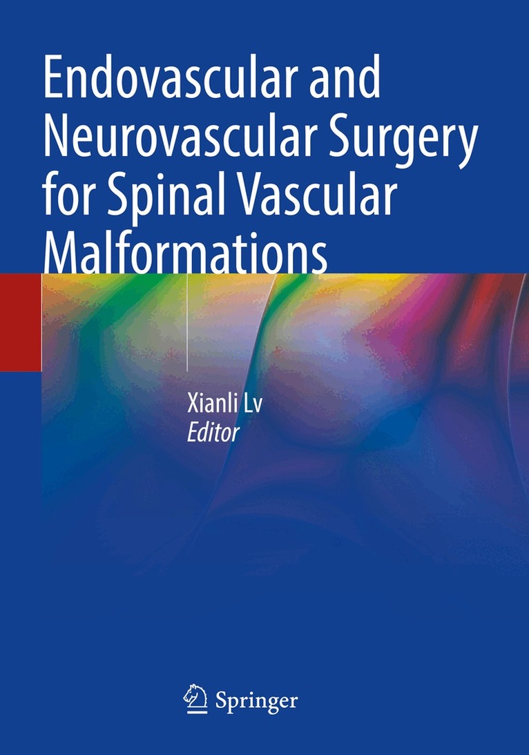 Xianli Lv - Endovascular and Neurovascular Surgery for Spinal Vascular Malformations, Häftad. Tillgänglighet: Lägg i varukorg
