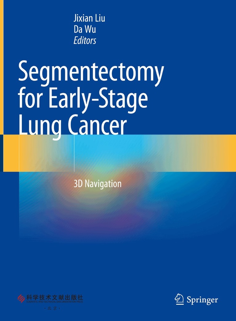 Jixian Liu, Da Wu - Segmentectomy for Early-Stage Lung Cancer, Inbunden
