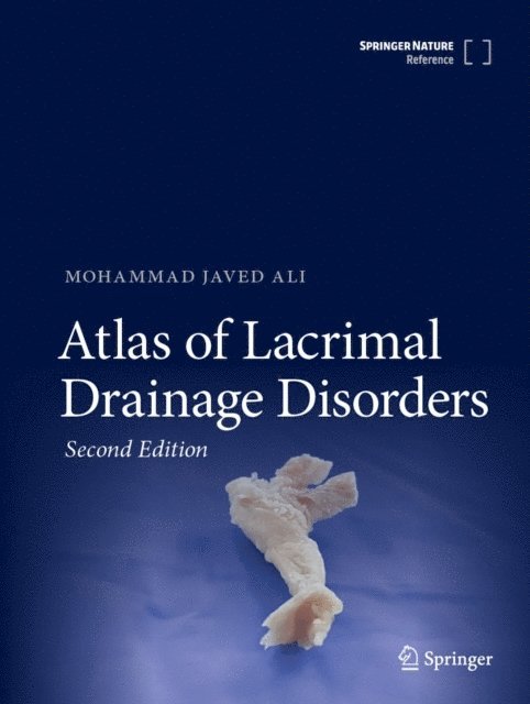 Mohammad Javed Ali - Atlas of Lacrimal Drainage Disorders, E-bok