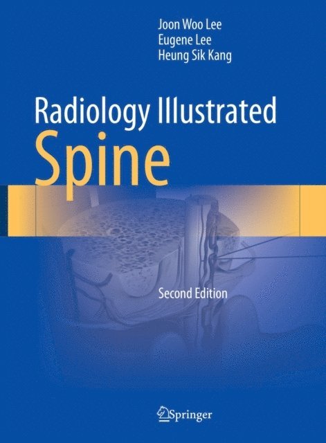 Heung Sik Kang, Eugene Lee, Joon Woo Lee - Radiology Illustrated: Spine, E-bok