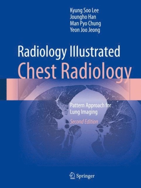 Yeon Joo Jeong, Man Pyo Chung, Joungho Han, Kyung Soo Lee - Radiology Illustrated: Chest Radiology, E-bok