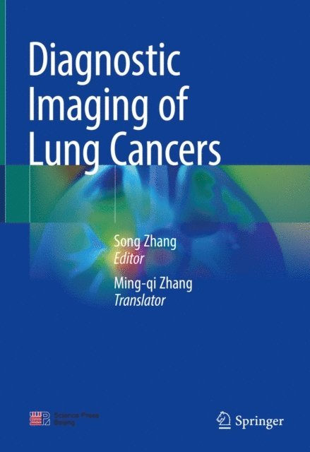 Song Zhang - Diagnostic Imaging of Lung Cancers, E-bok