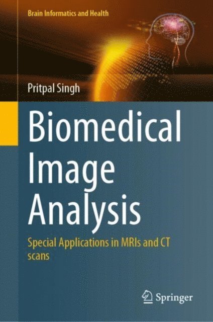 Pritpal Singh - Biomedical Image Analysis, E-bok