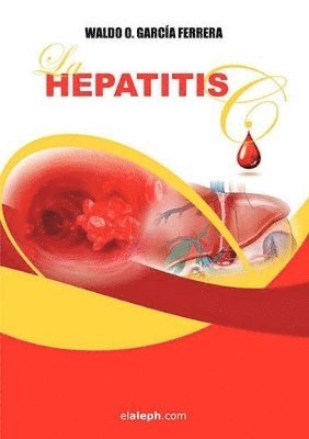 Waldo O Garca Ferrera, Waldo O Garcia Ferrera - Hepatitis C, Häftad