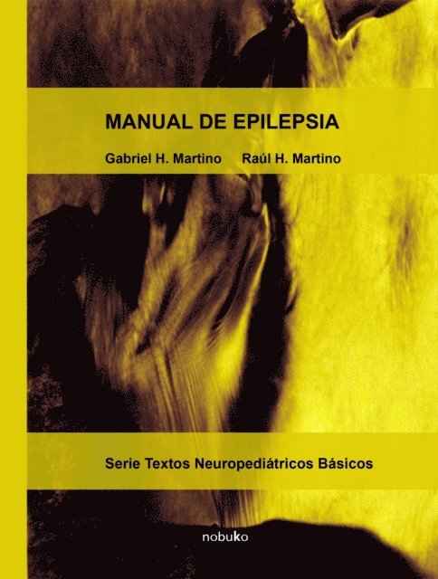 Raul Martino, Gabriel Martino - Manual de epilepsia, E-bok. Tillgänglighet: Lägg i varukorg