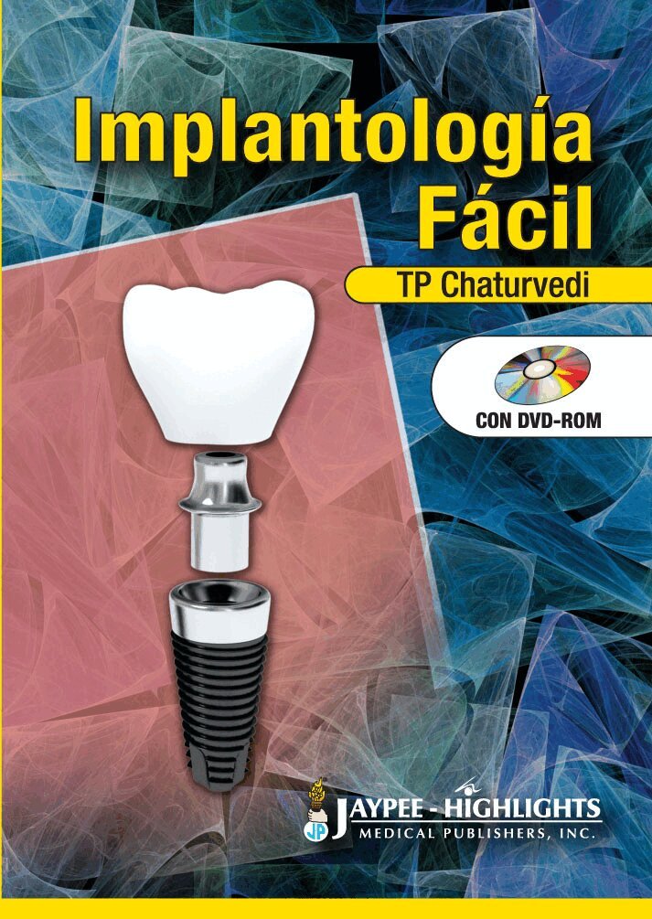 TP Chaturvedi - Implantología Fácil, Inbunden. Tillgänglighet: Tillfälligt slut