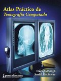Atlas Practico de Tomografia Computada
